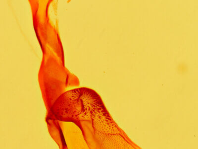 genitalia view of adult Tarache geminoculaFerris & Laf, 2009