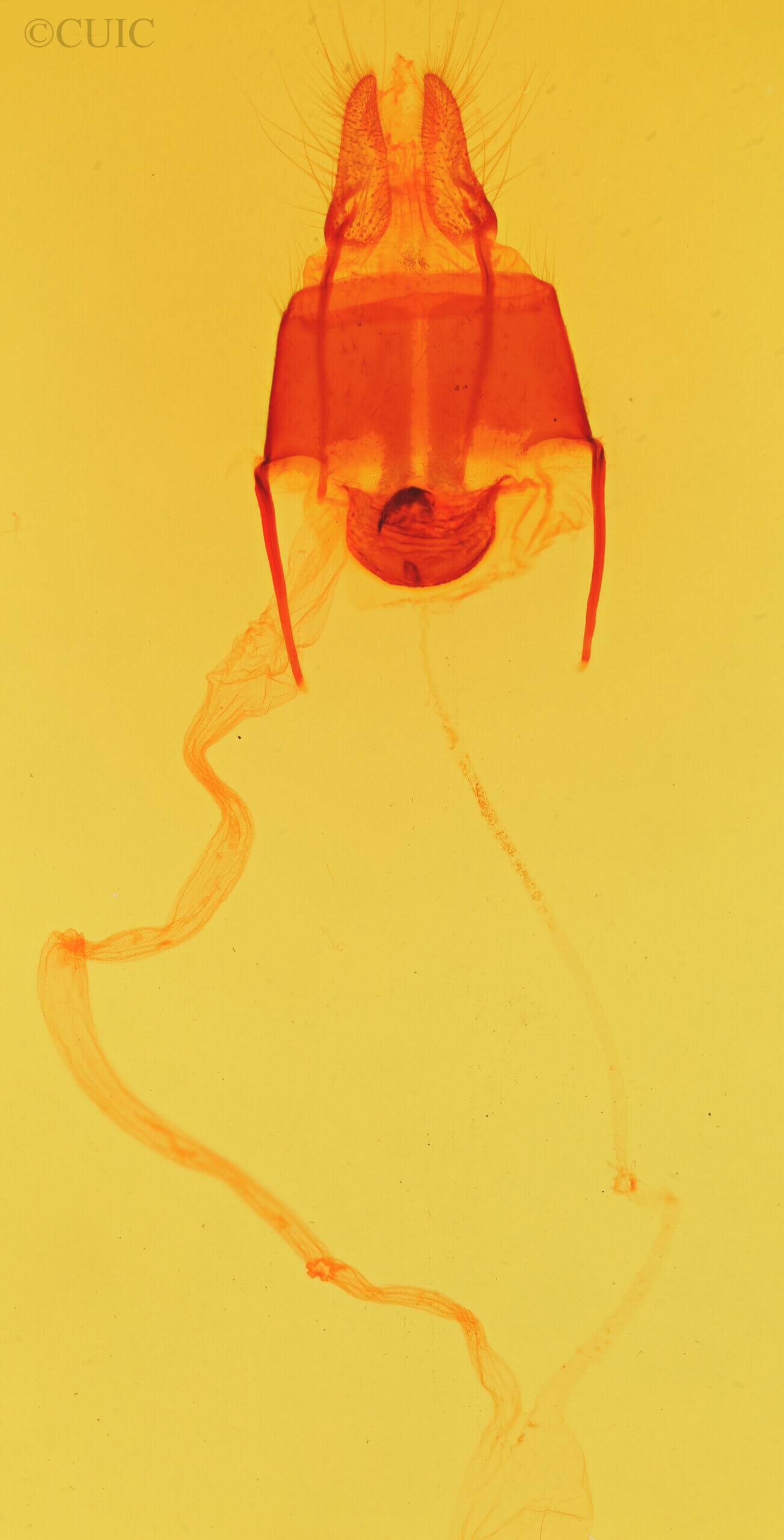 genitalia view of adult Aucula ? magnifica