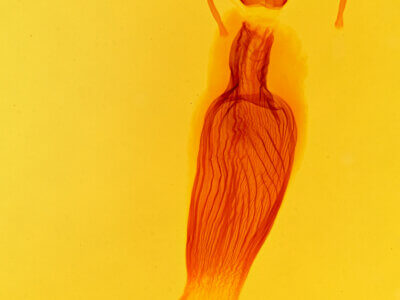 genitalia view of adult Helotropha reniformis