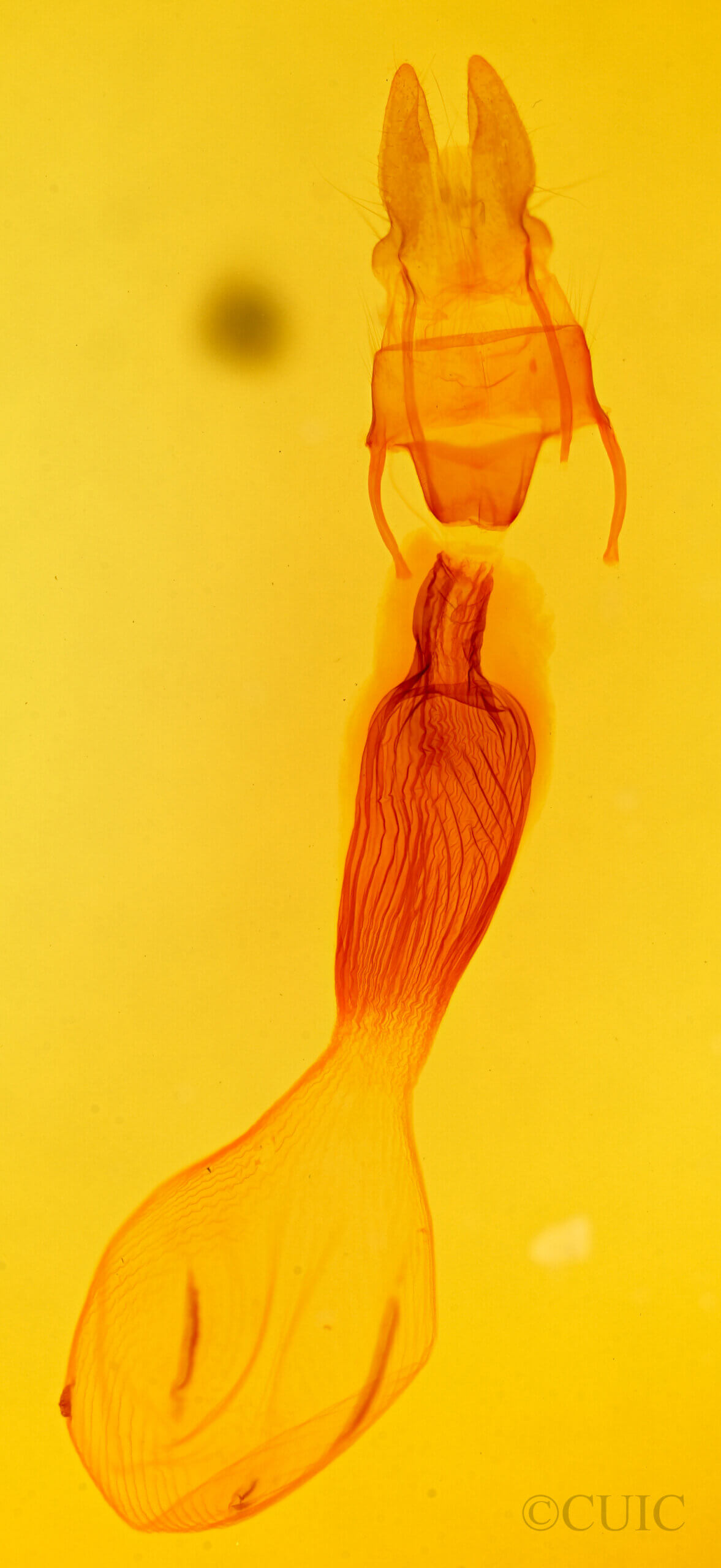 genitalia view of adult Helotropha reniformis