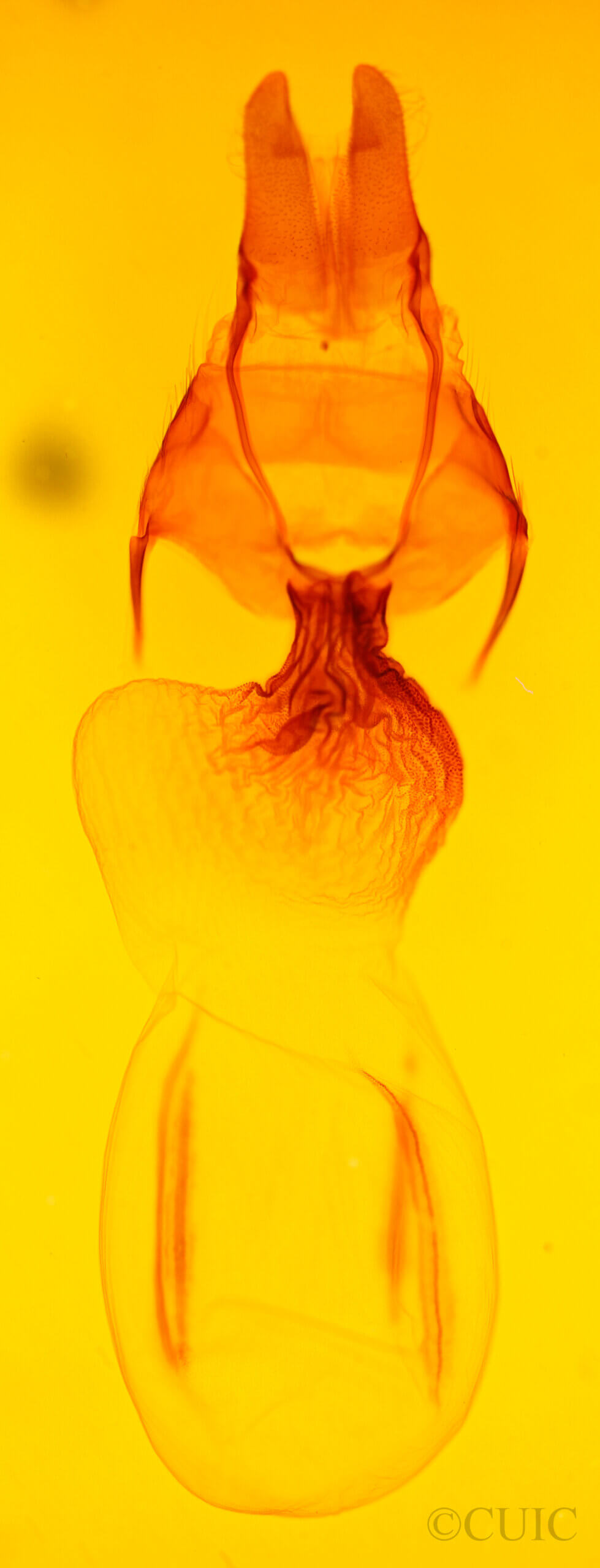 genitalia view of adult Apamea contradicta