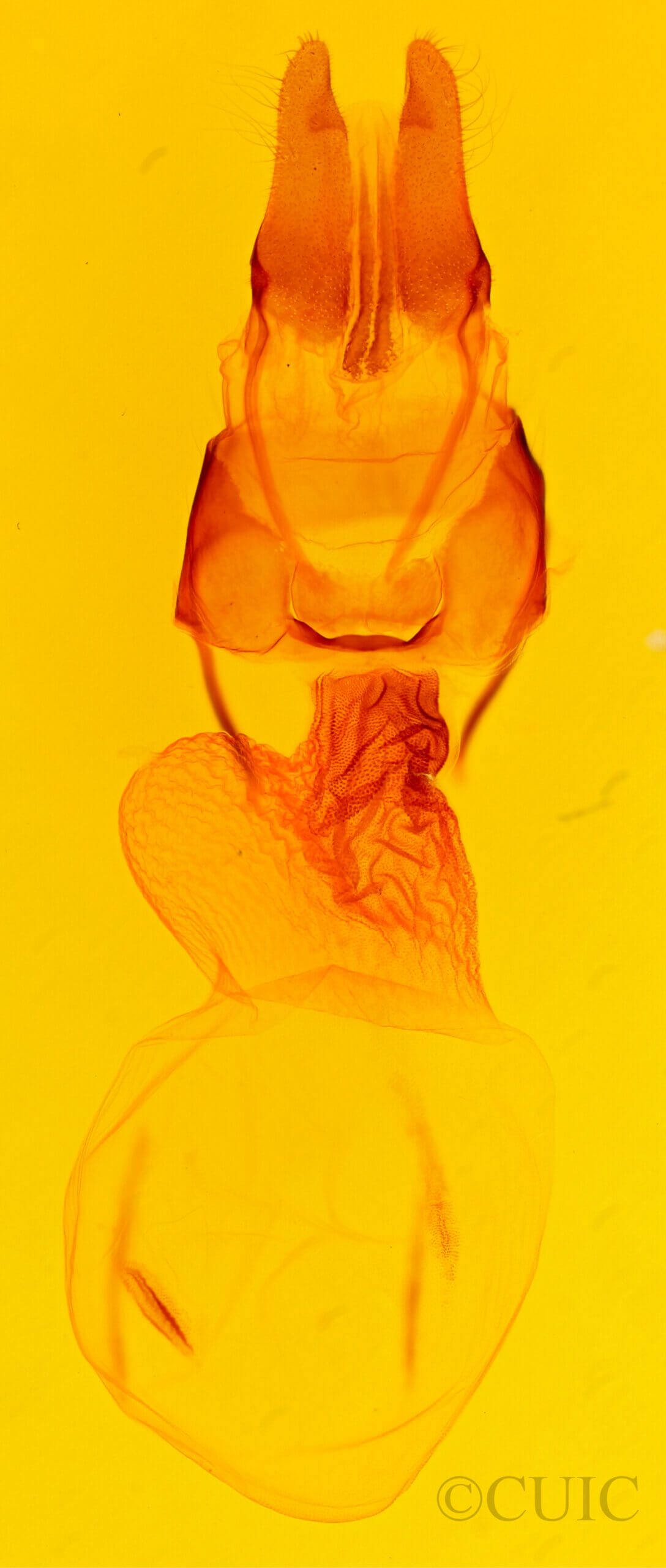 genitalia view of adult Apamea commoda