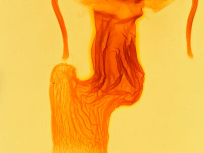 genitalia view of adult Apamea dubitans