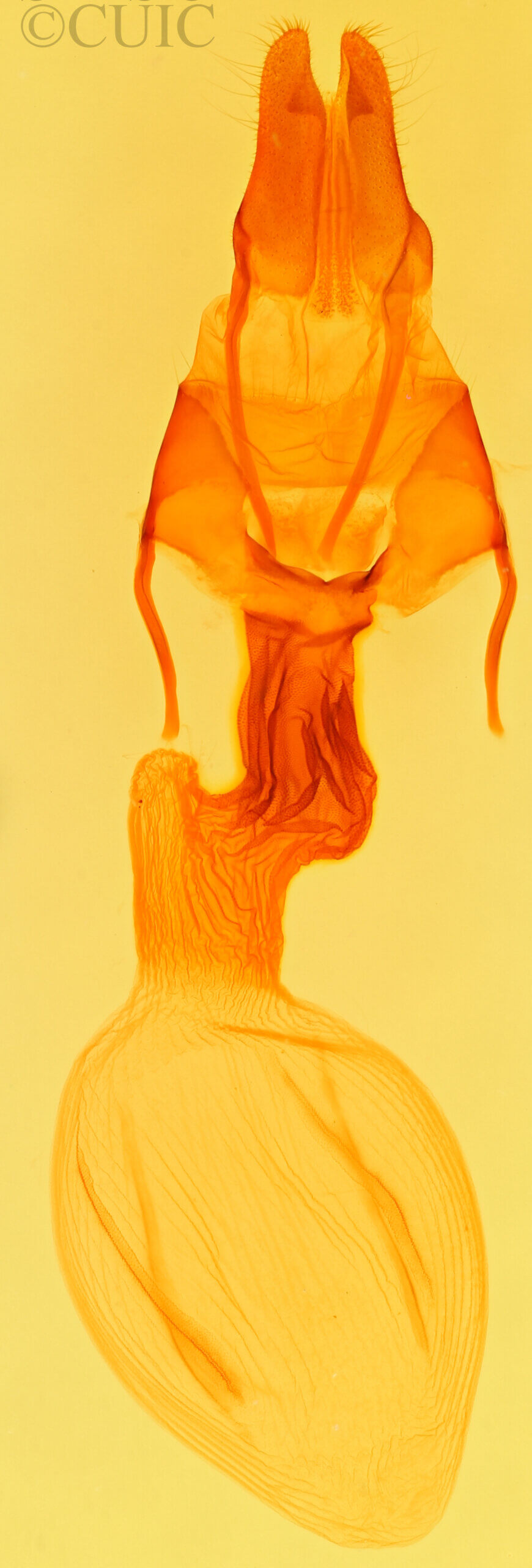 genitalia view of adult Apamea dubitans