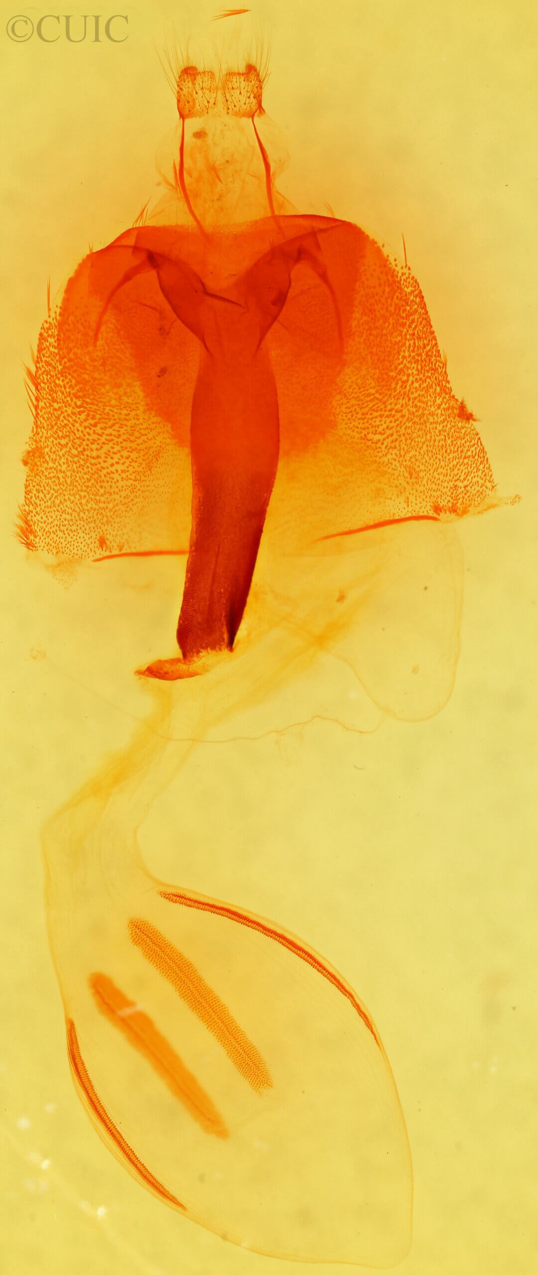 genitalia view of adult Egira crucialis