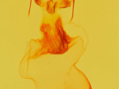 genitalia view of adult Azeta sp.