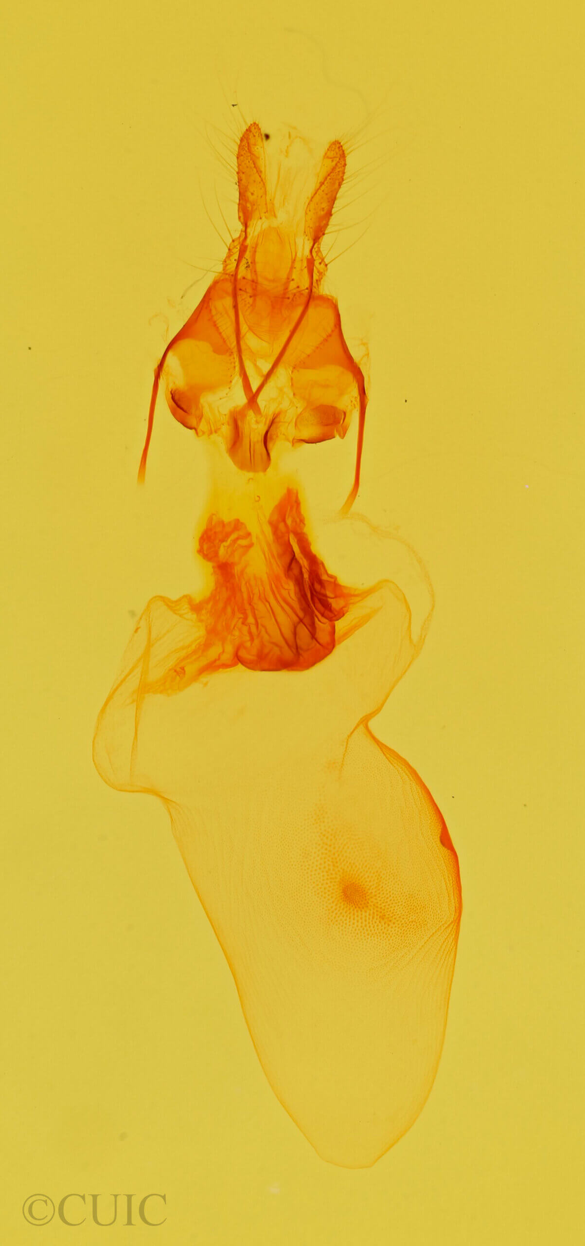 genitalia view of adult Azeta sp.