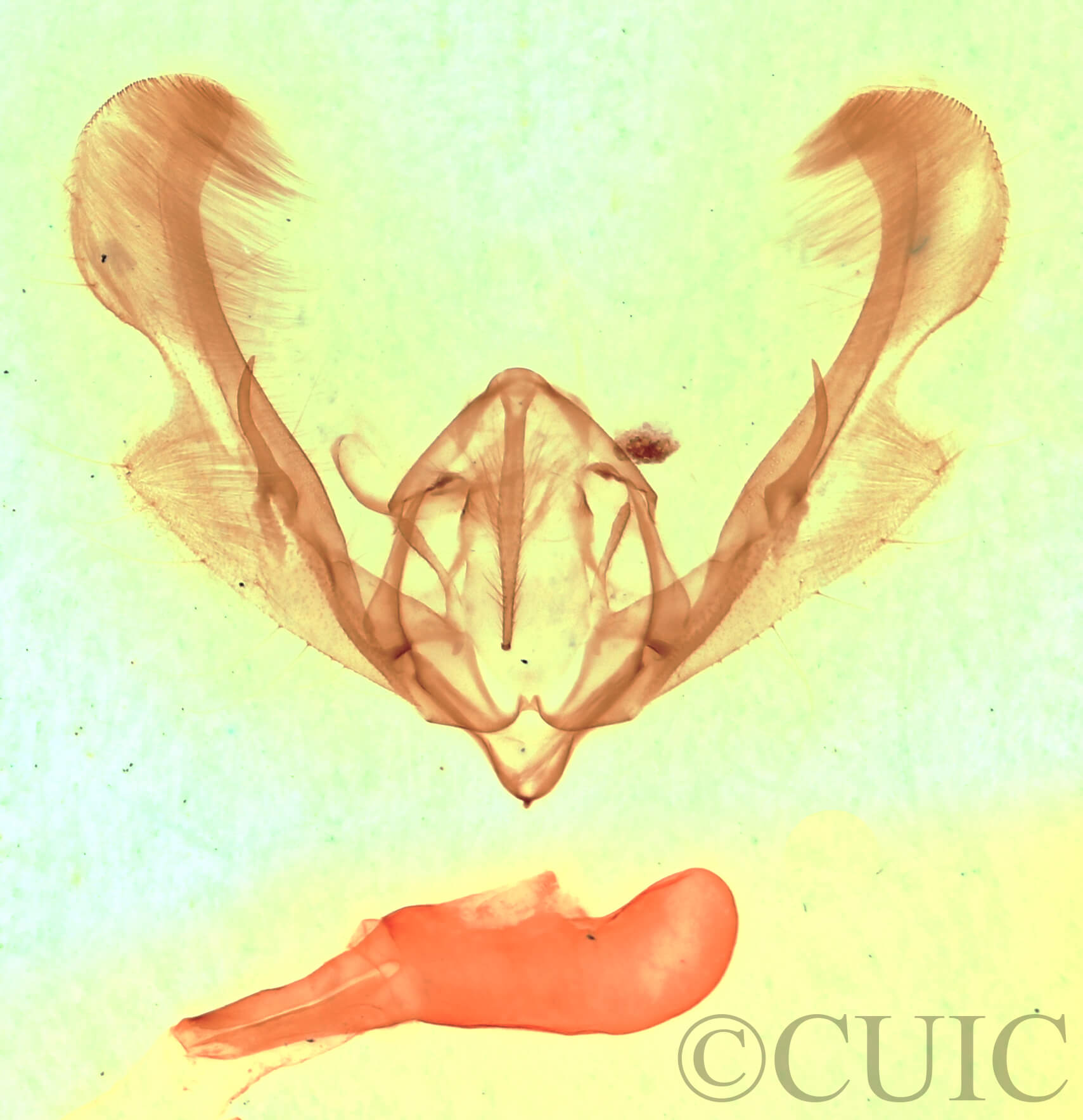 genitalia view of adult Anicla cemolia