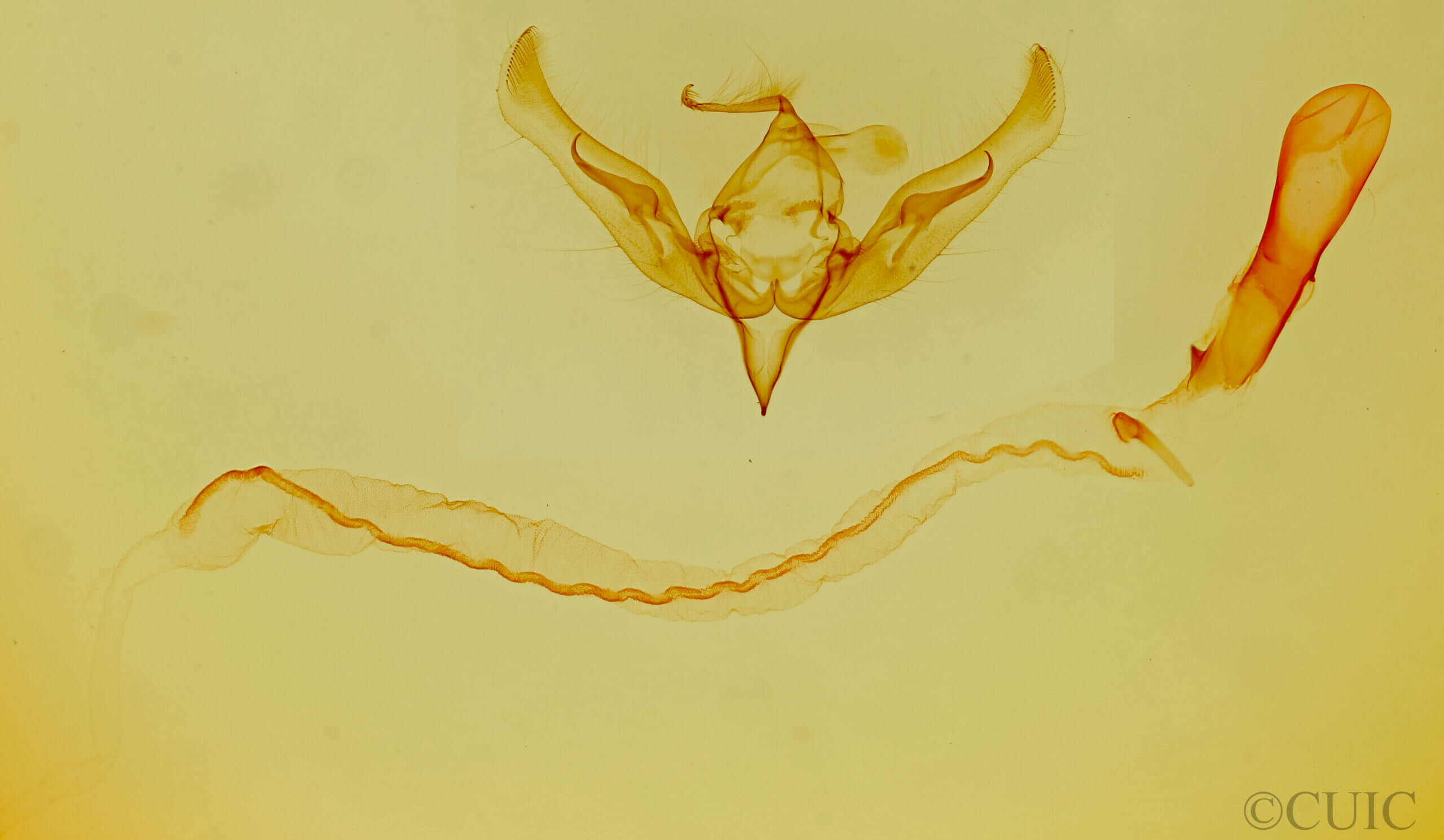 genitalia view of adult Anicla exuberans