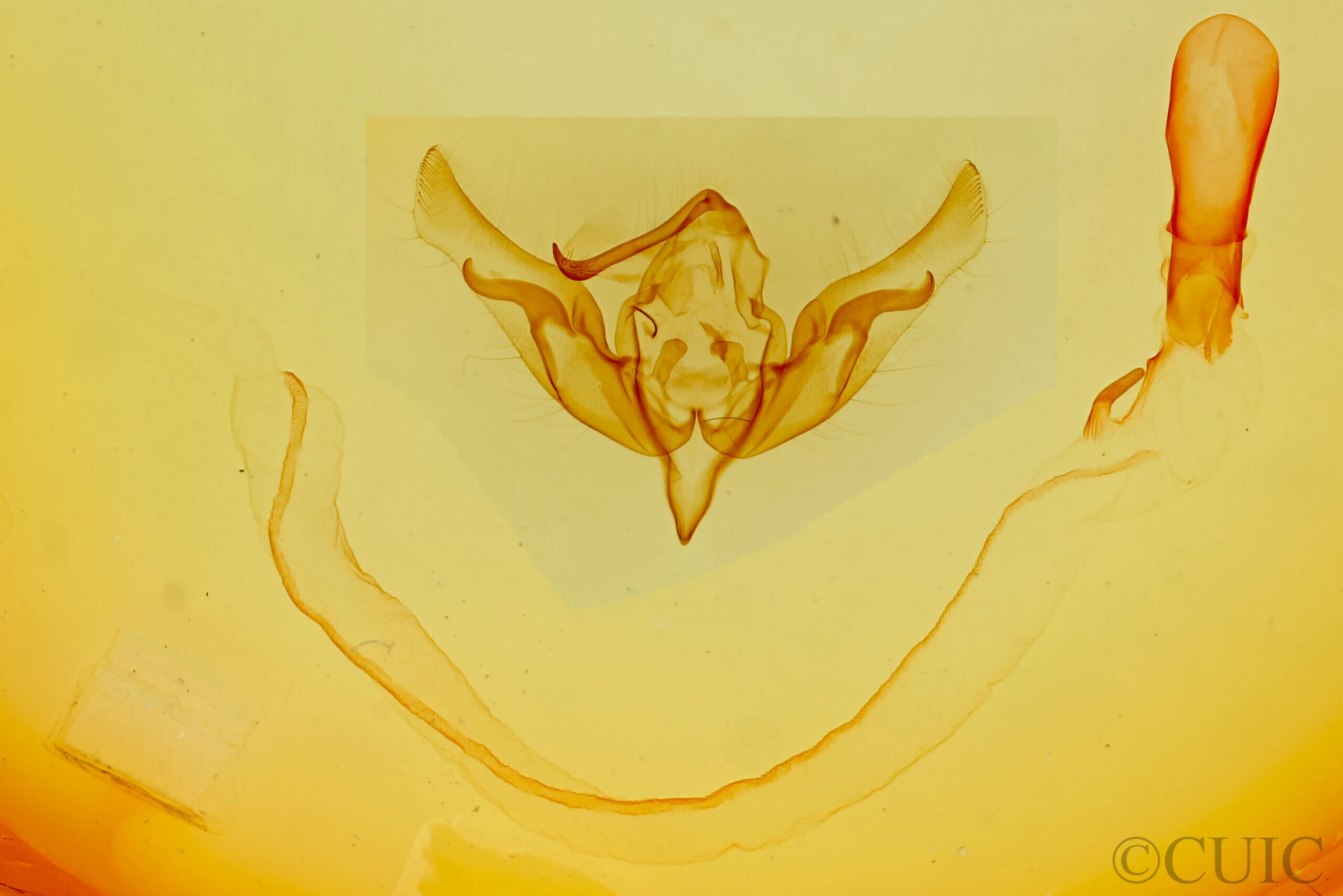 genitalia view of adult Anicla digna