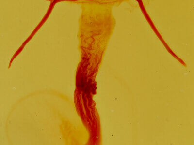 genitalia view of adult Achatia distincta