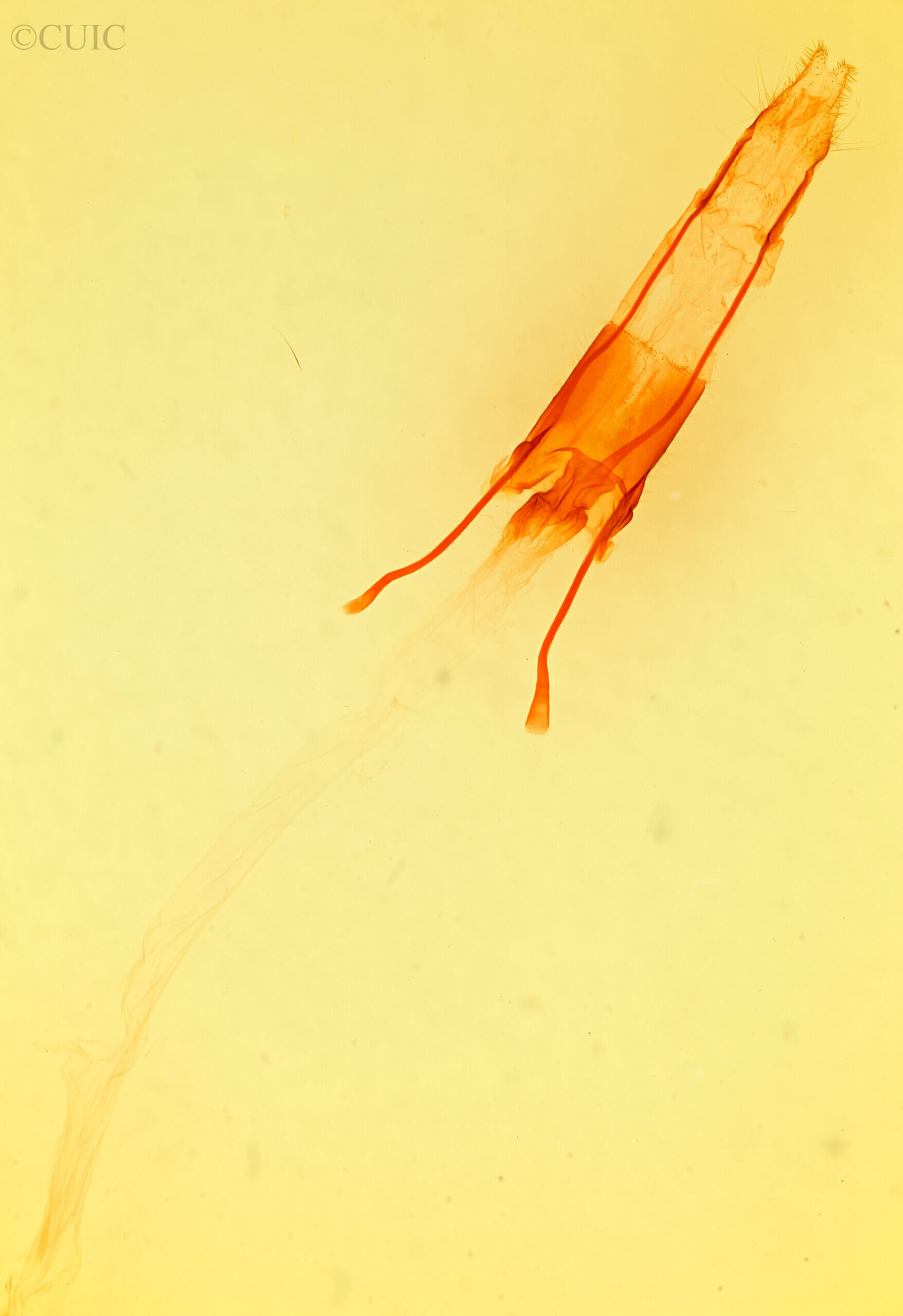 genitalia view of adult Enargia infumata?