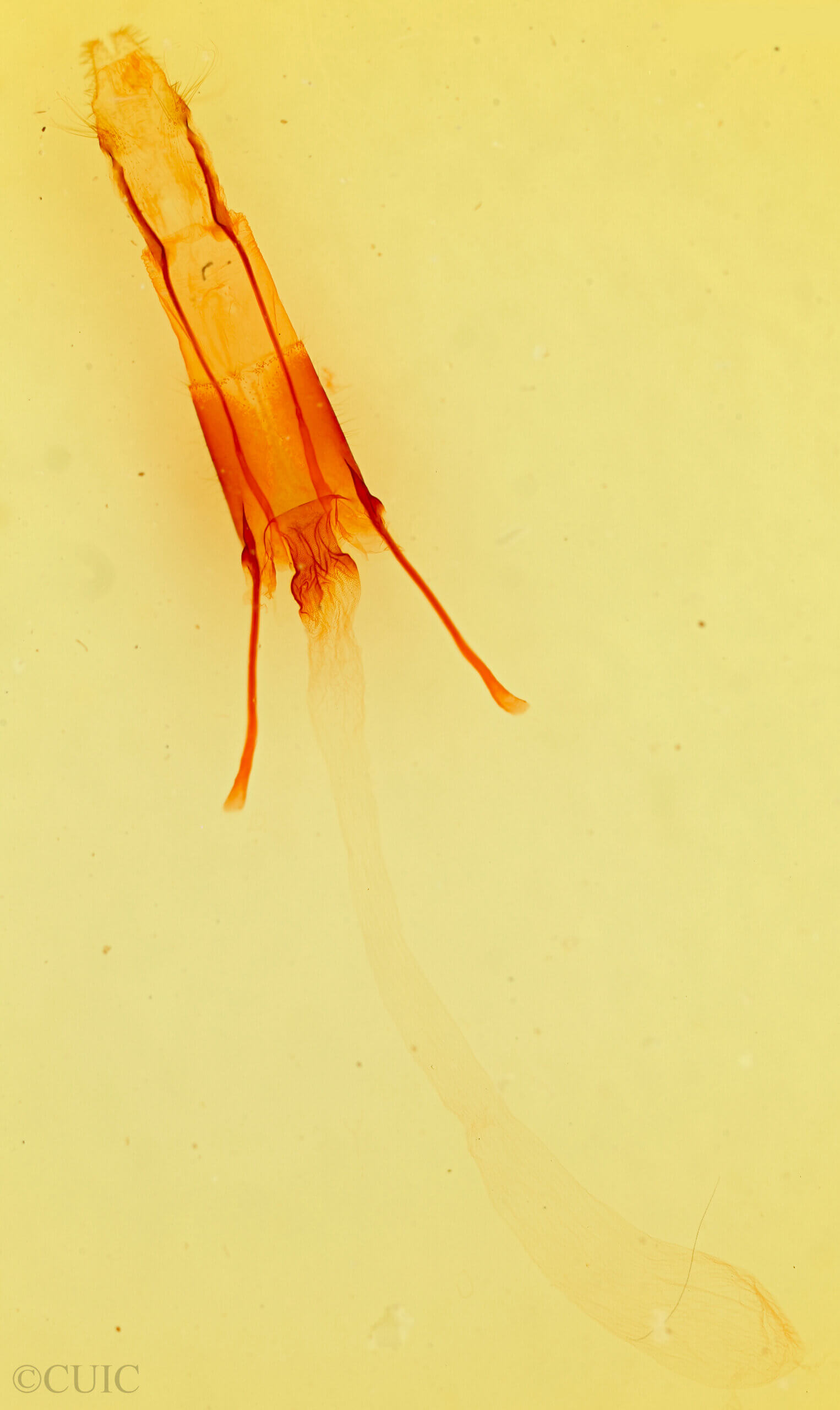 genitalia view of adult Enargia infumata?