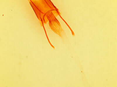 genitalia view of adult Enargia decolor