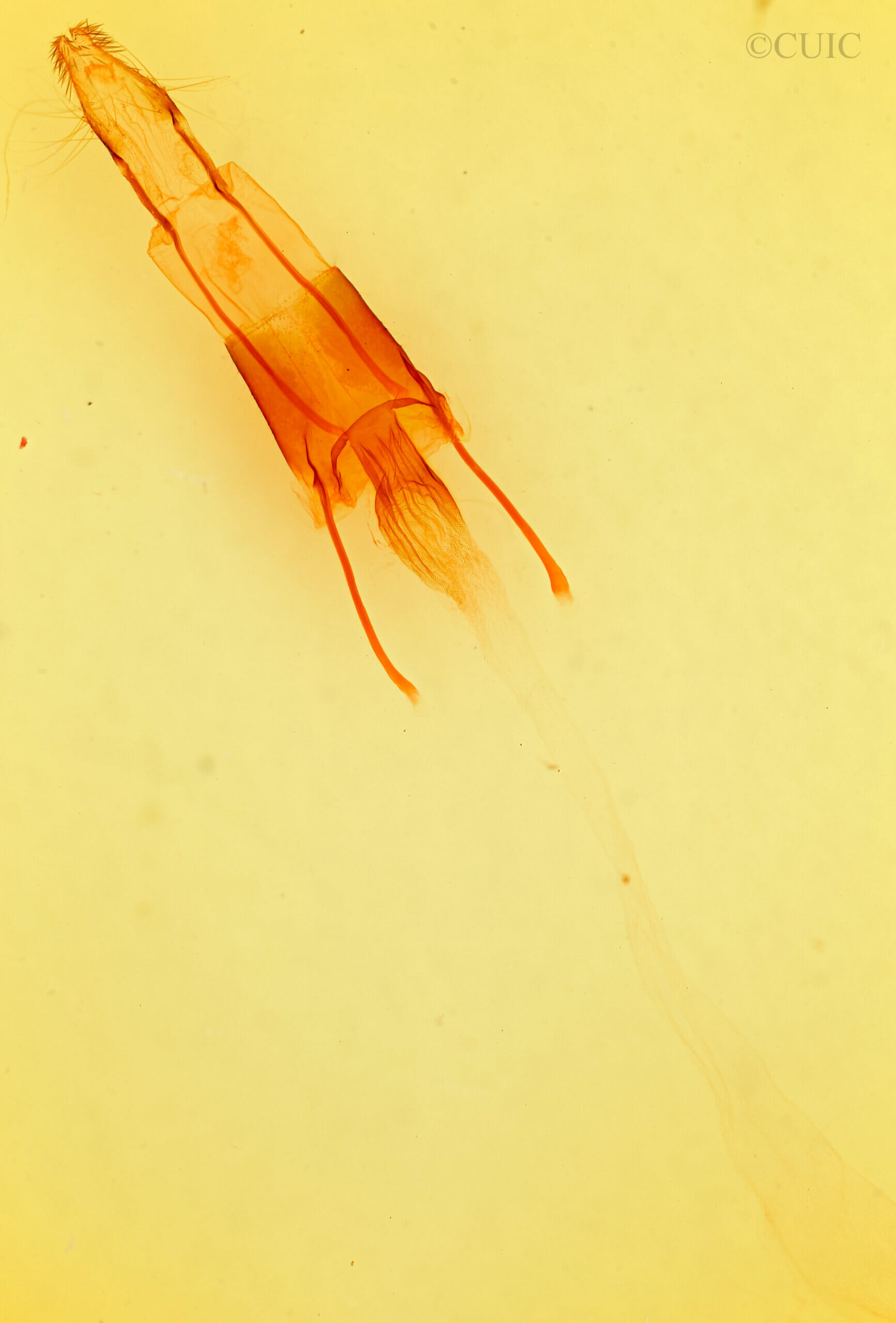 genitalia view of adult Enargia decolor