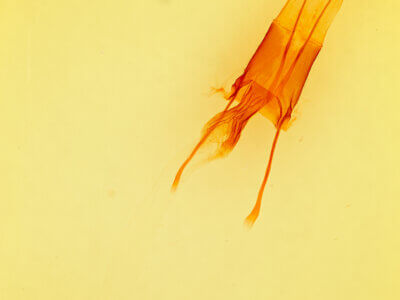 genitalia view of adult Enargia decolor