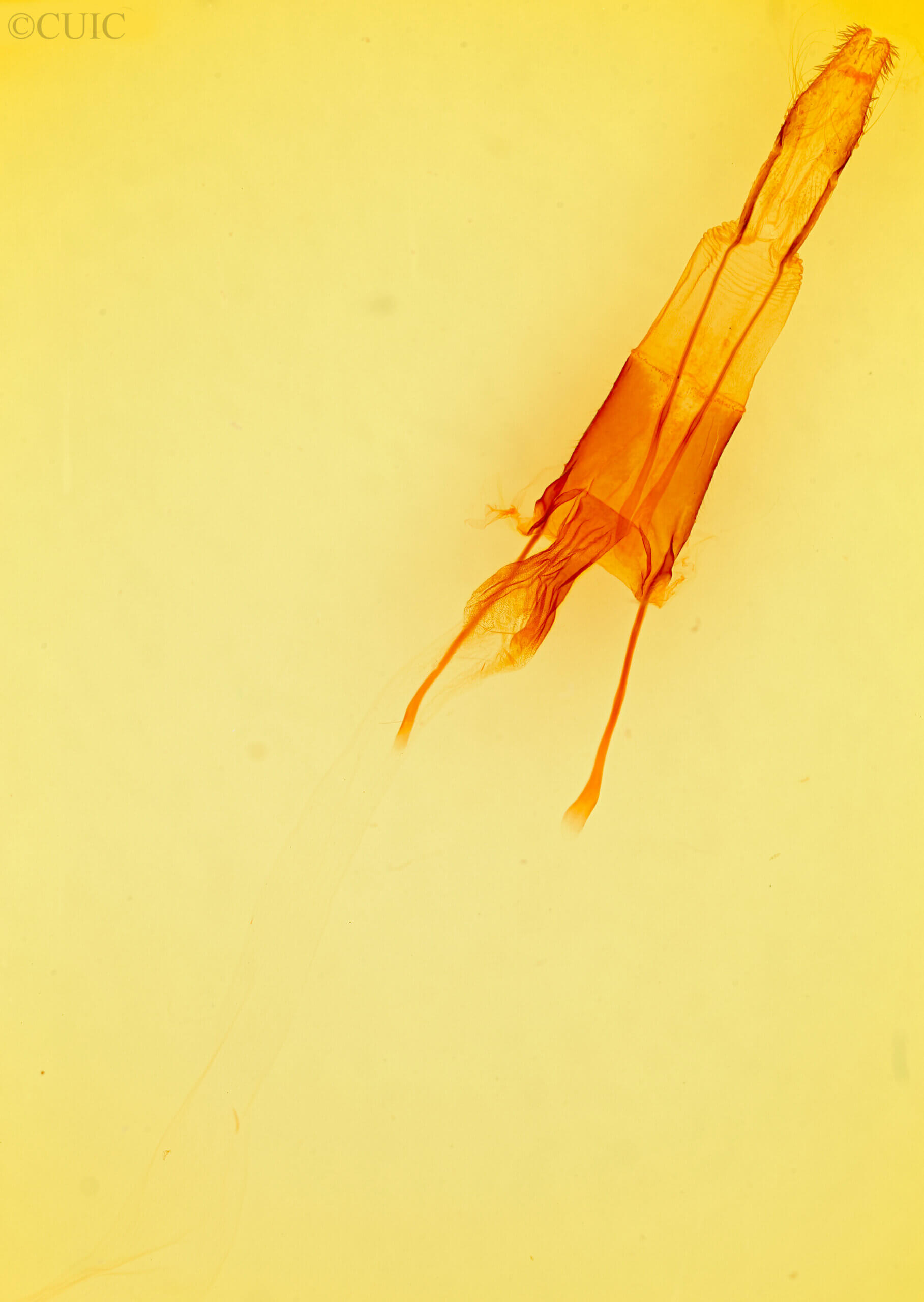 genitalia view of adult Enargia decolor