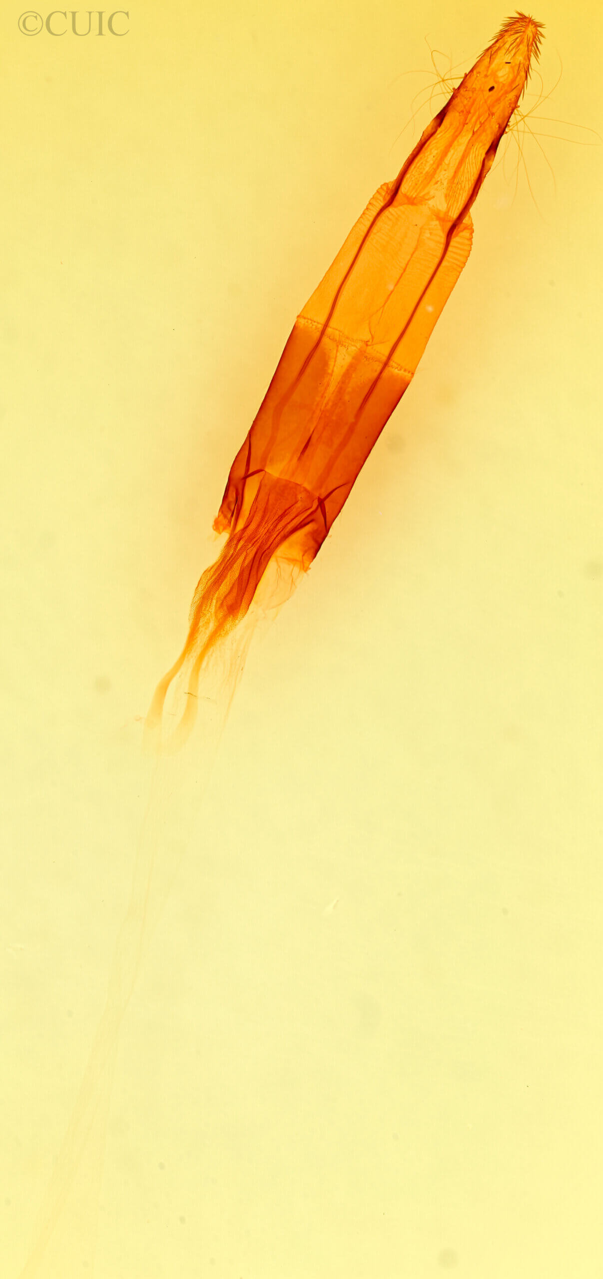 genitalia view of adult Enargia decolor