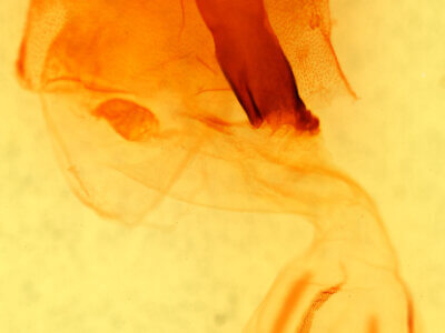 genitalia view of adult Egira simplex