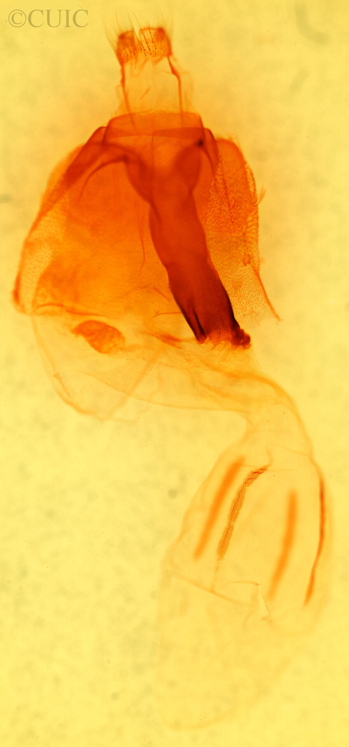 genitalia view of adult Egira simplex