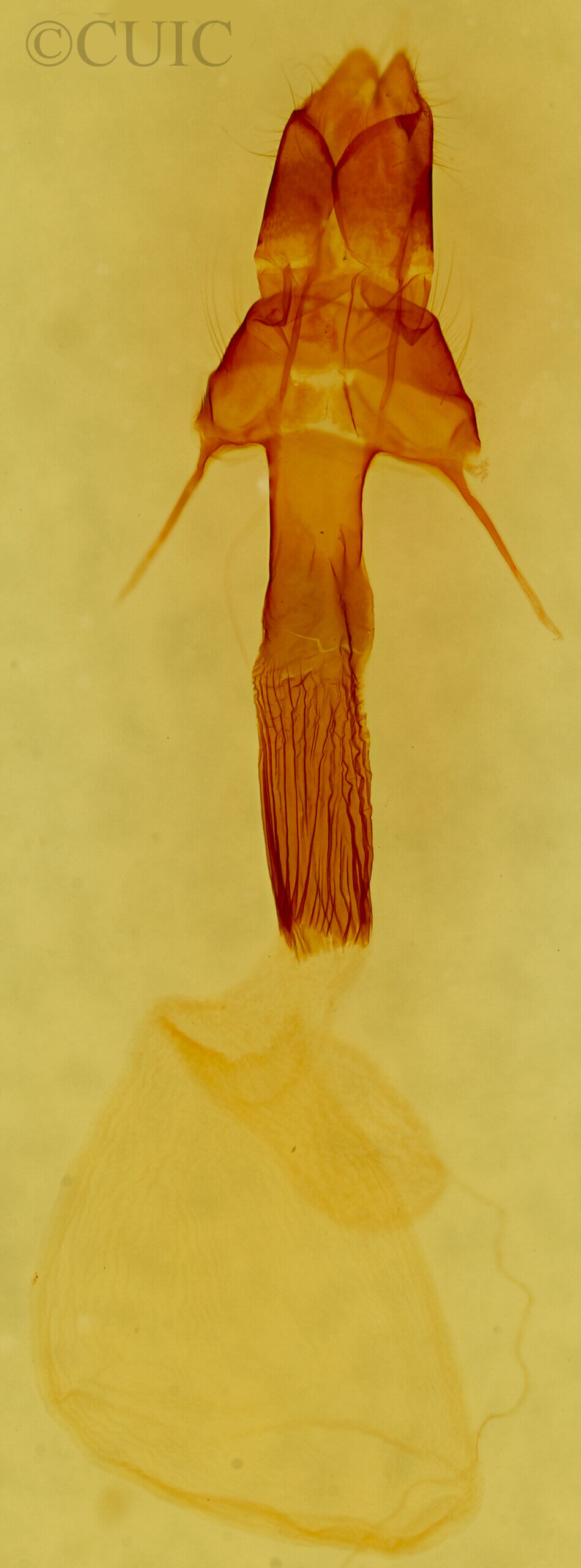 genitalia view of adult Mythimna