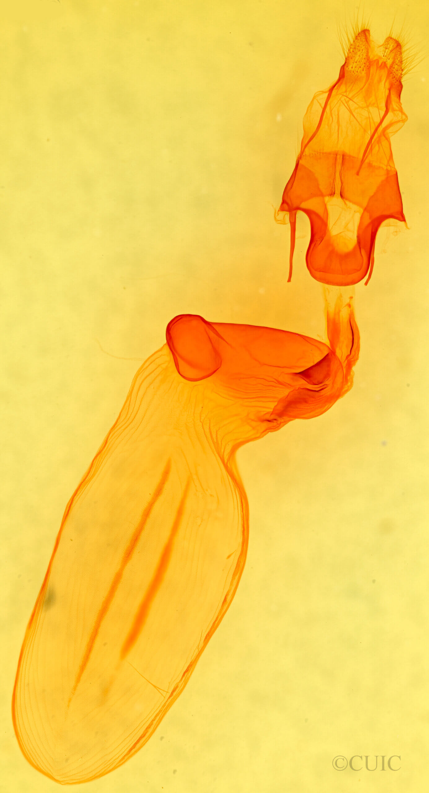 genitalia view of adult Eupsilia tristigmata