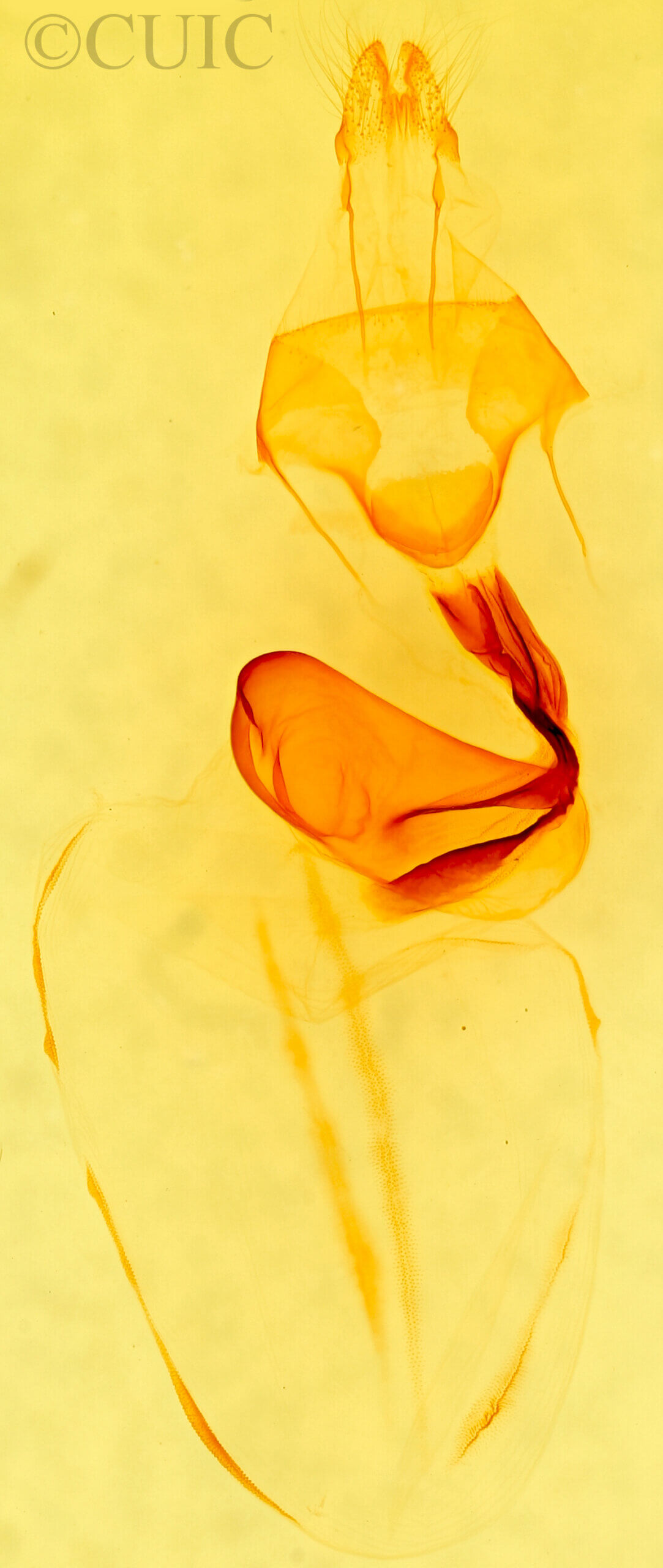 genitalia view of adult Eupsilia devia