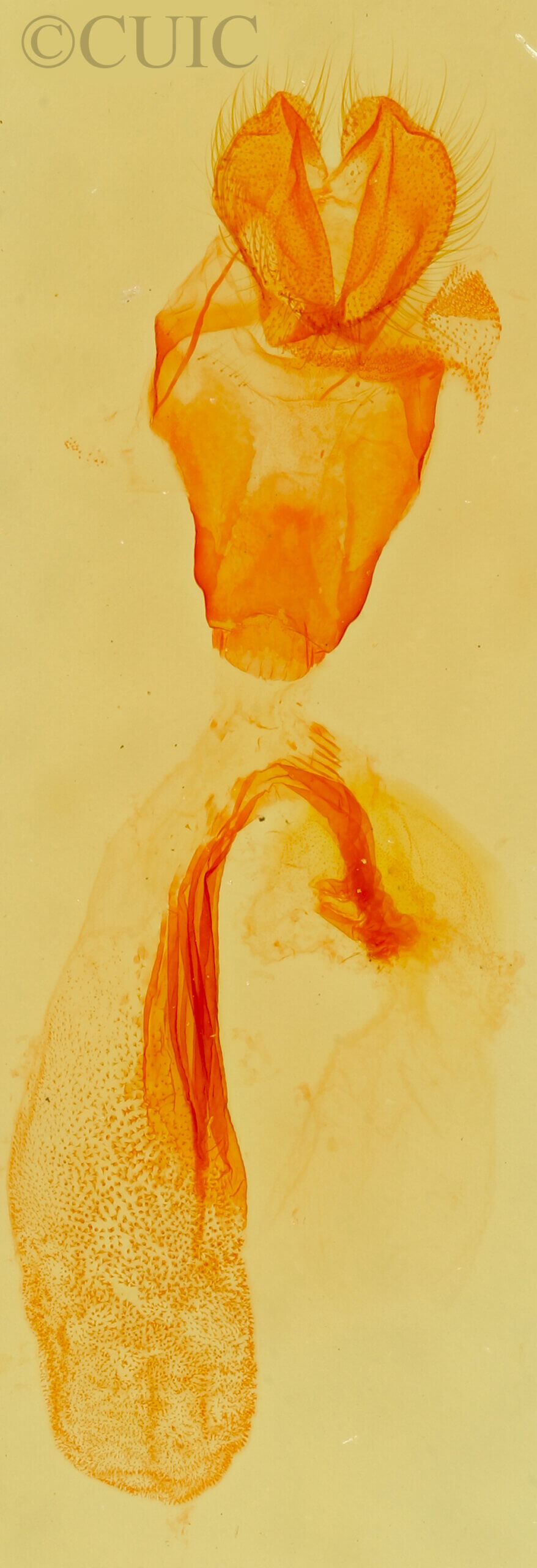 genitalia view of adult Paectes abrostolella