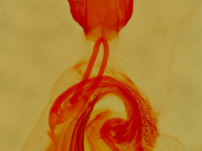 genitalia view of adult Paectes abrostolella