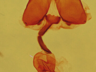 genitalia view of adult Metalectra geminicincta