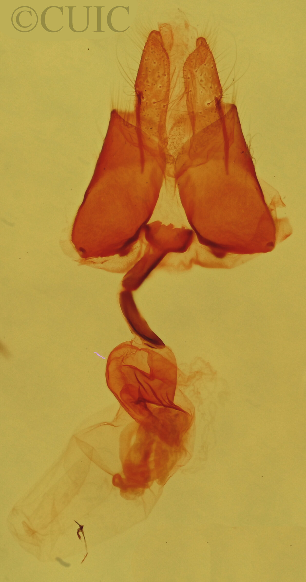 genitalia view of adult Metalectra geminicincta
