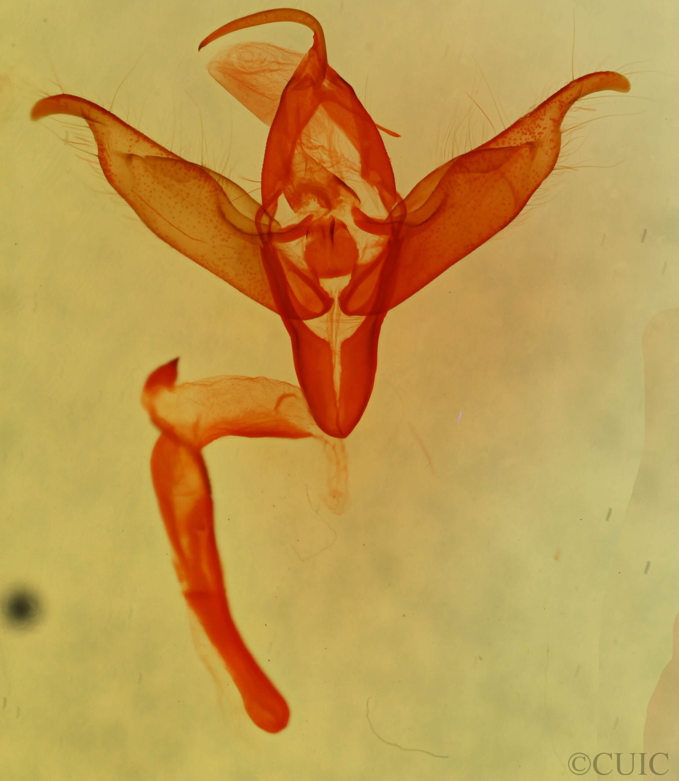 genitalia view of adult Abagrotis trigona