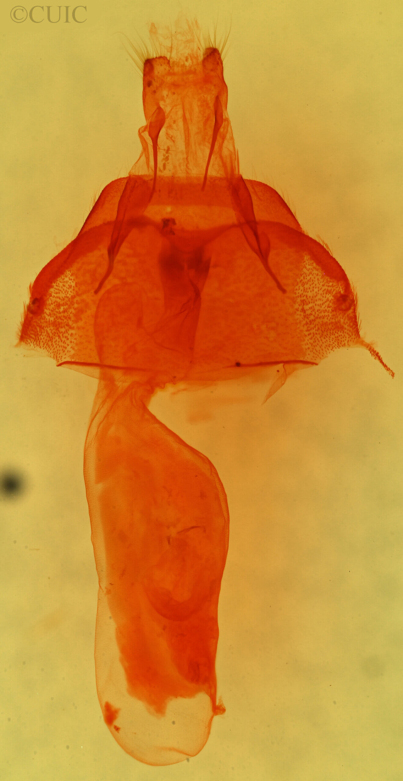 genitalia view of adult Abagrotis trigona