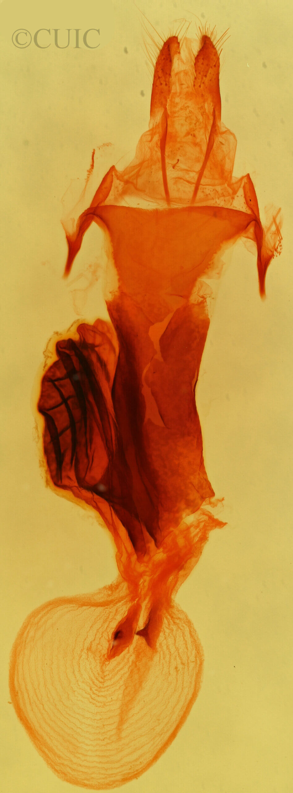 genitalia view of adult Abagrotis erratica