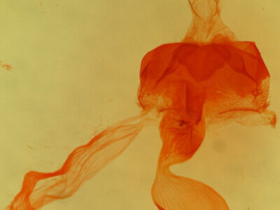 genitalia view of adult Abagrotis sp.