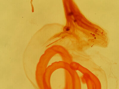 genitalia view of adult Elaphria festivoides