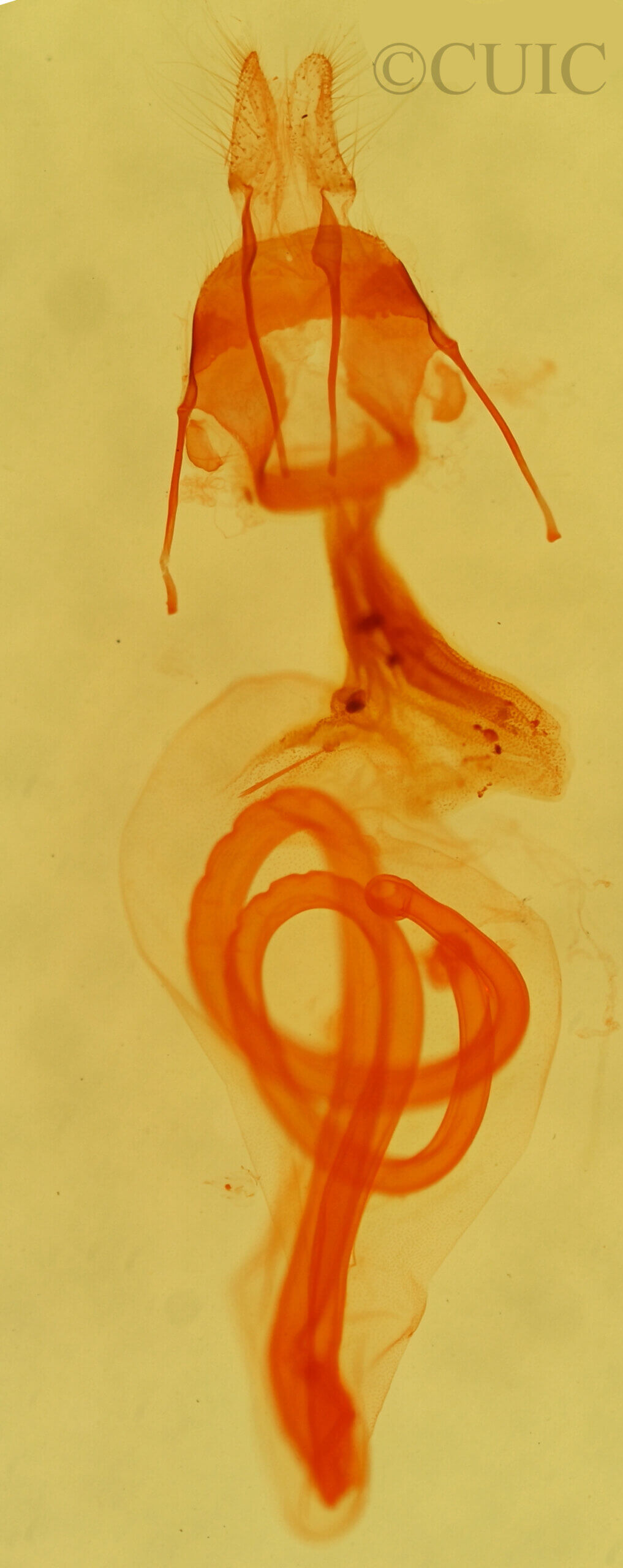 genitalia view of adult Elaphria festivoides