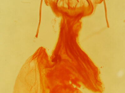 genitalia view of adult Elaphria festivoides