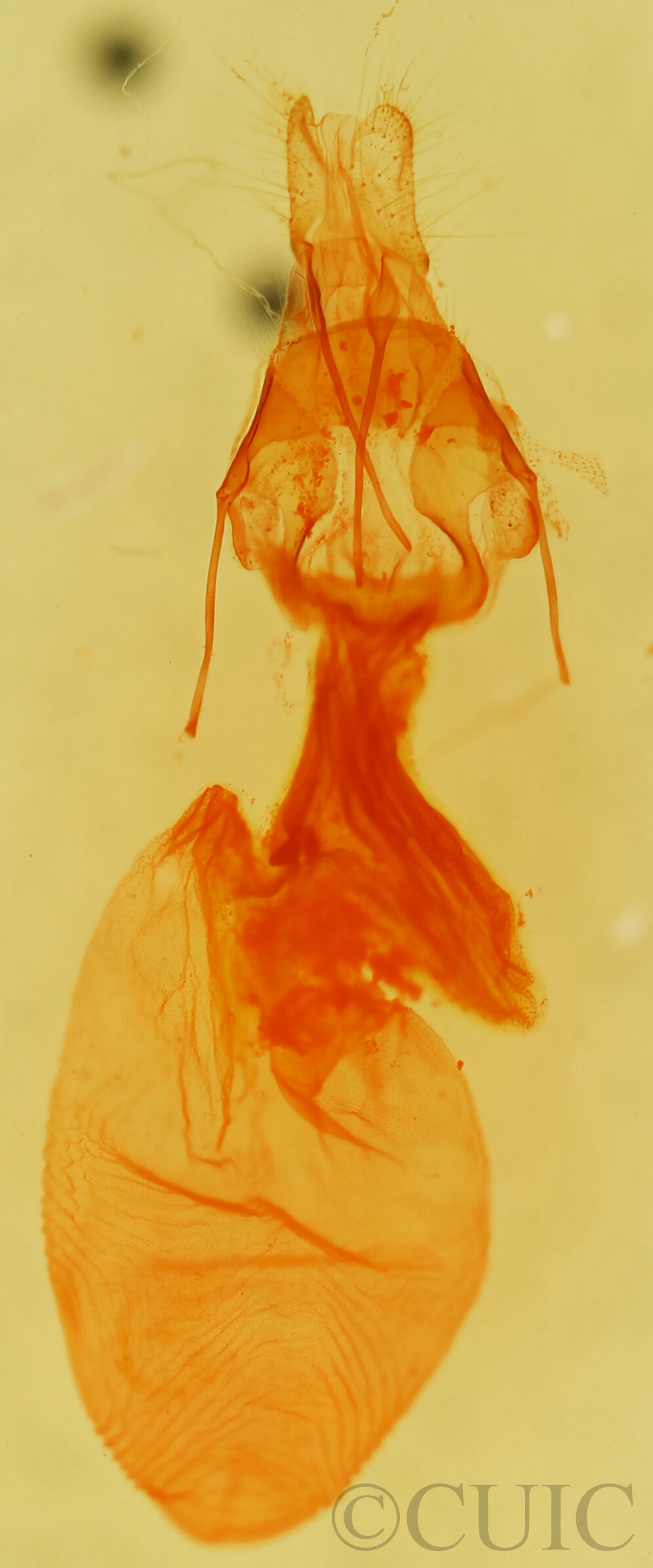 genitalia view of adult Elaphria festivoides