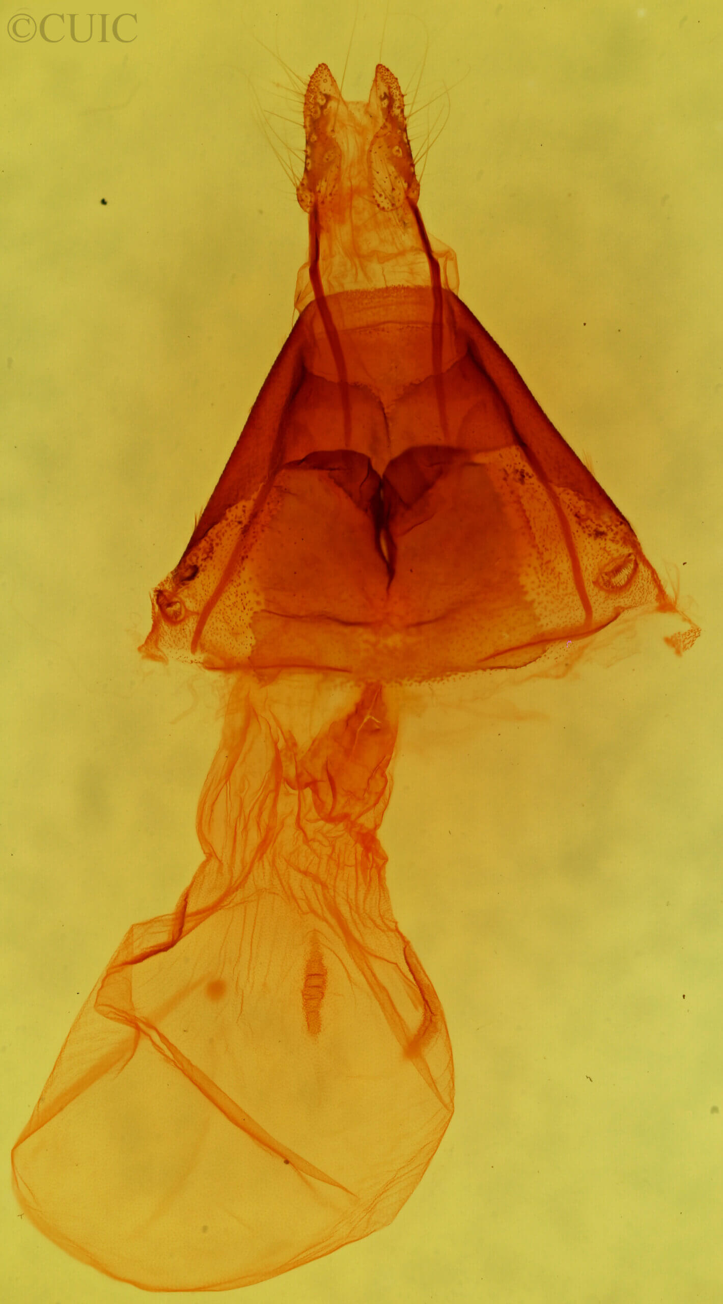 genitalia view of adult Nedra stewarti