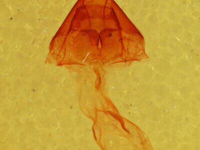 genitalia view of adult Nedra stewarti