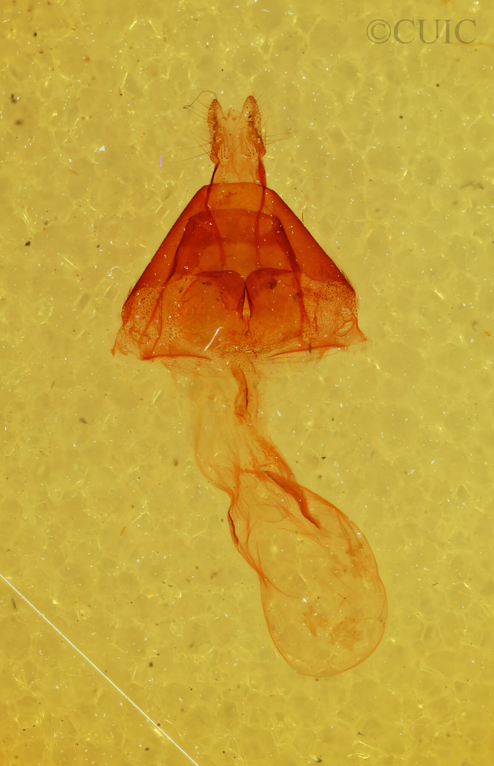 genitalia view of adult Nedra stewarti