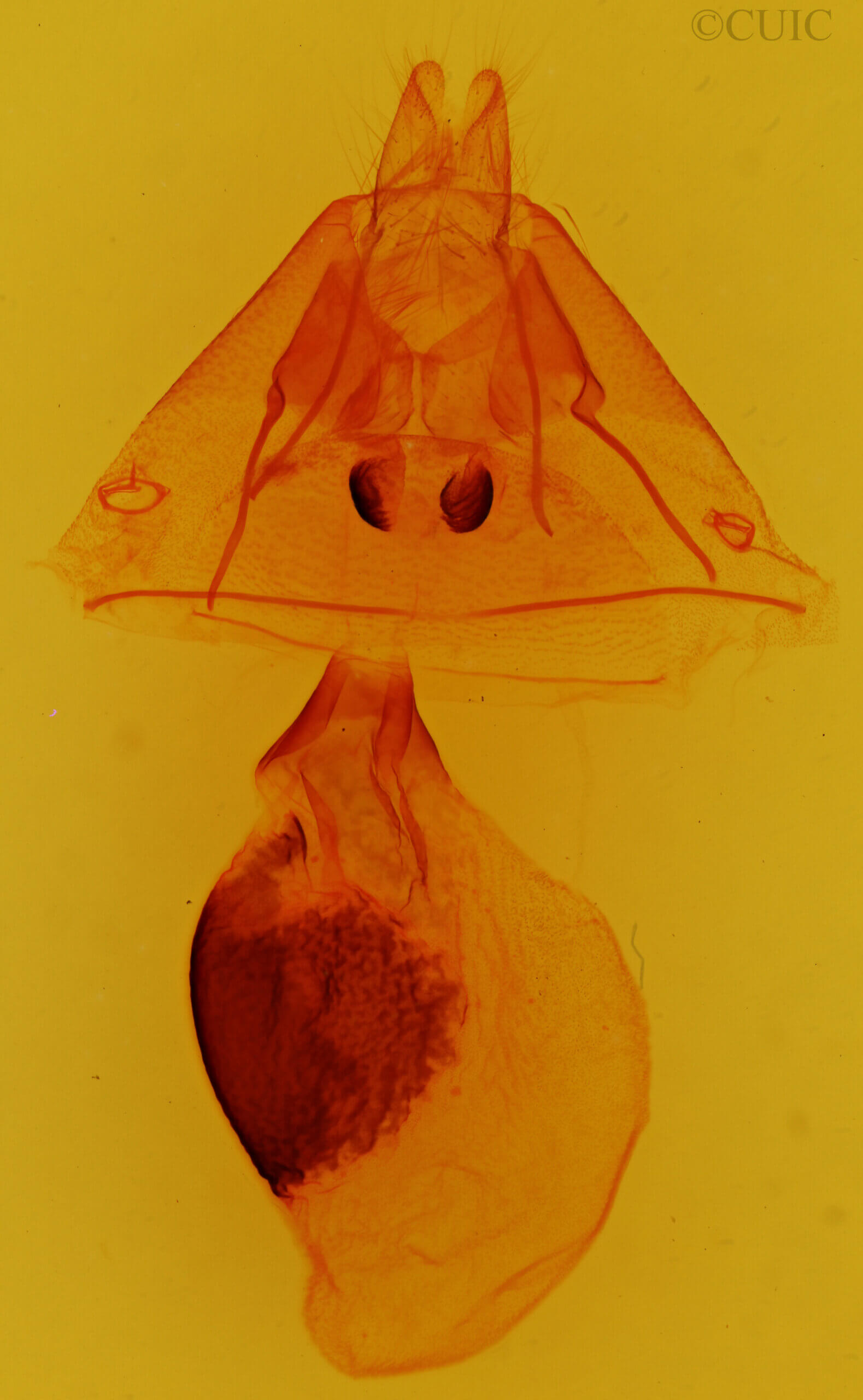 genitalia view of adult Athyrma floridana n. sp.