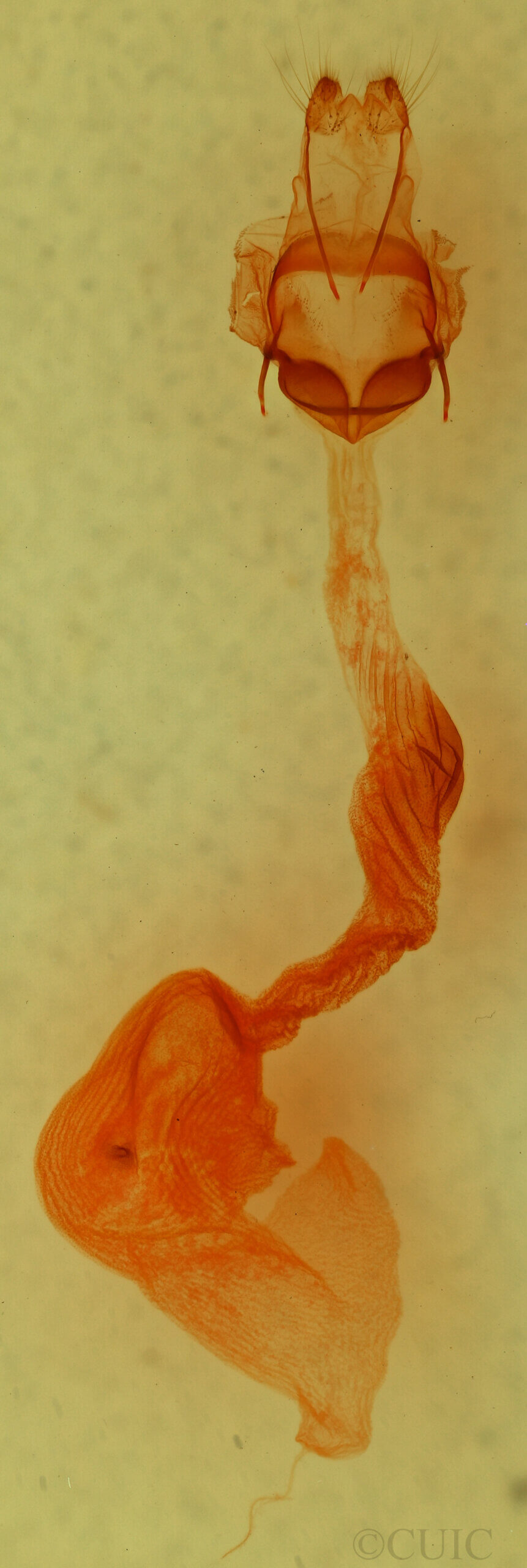 genitalia view of adult Anicla infecta