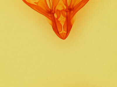 genitalia view of adult Drasteria mirifica