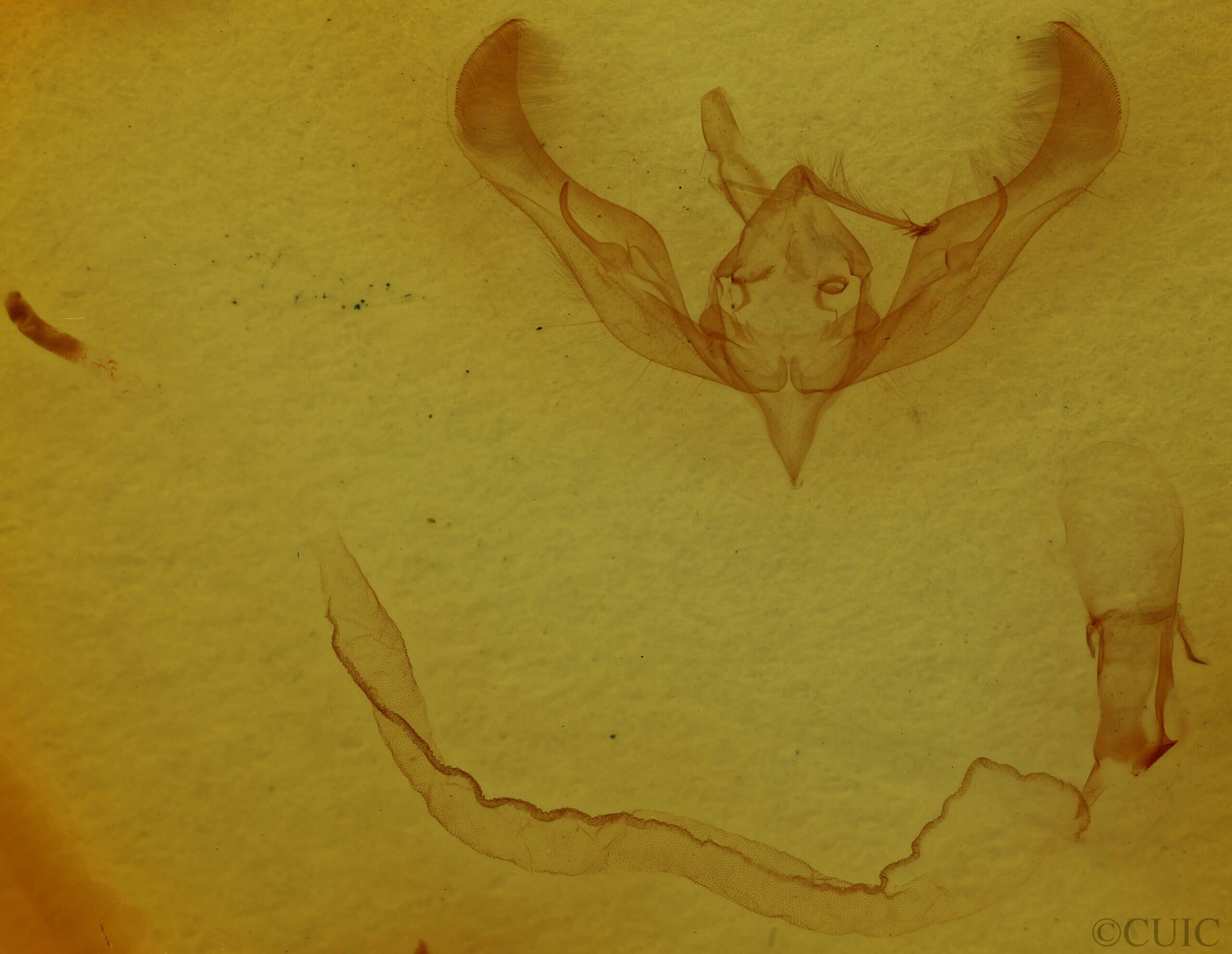 genitalia view of adult Anicla illapsa