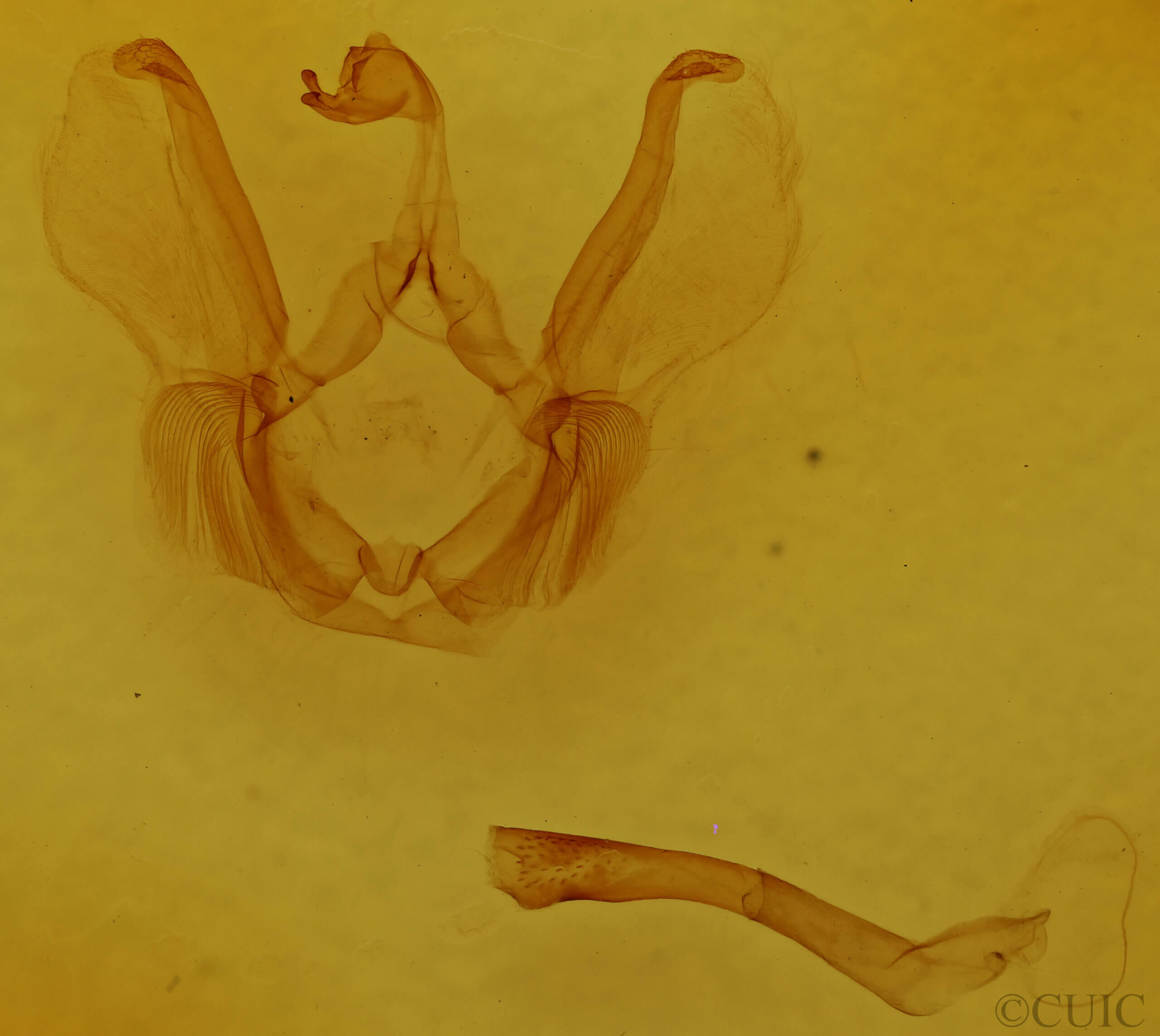 genitalia view of adult Tachuda sp.