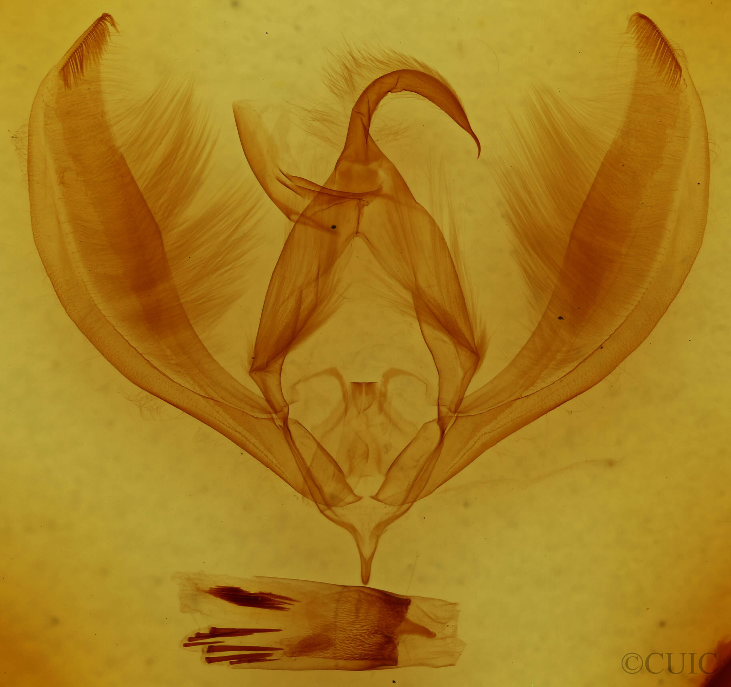 genitalia view of adult Paratrachea sp.