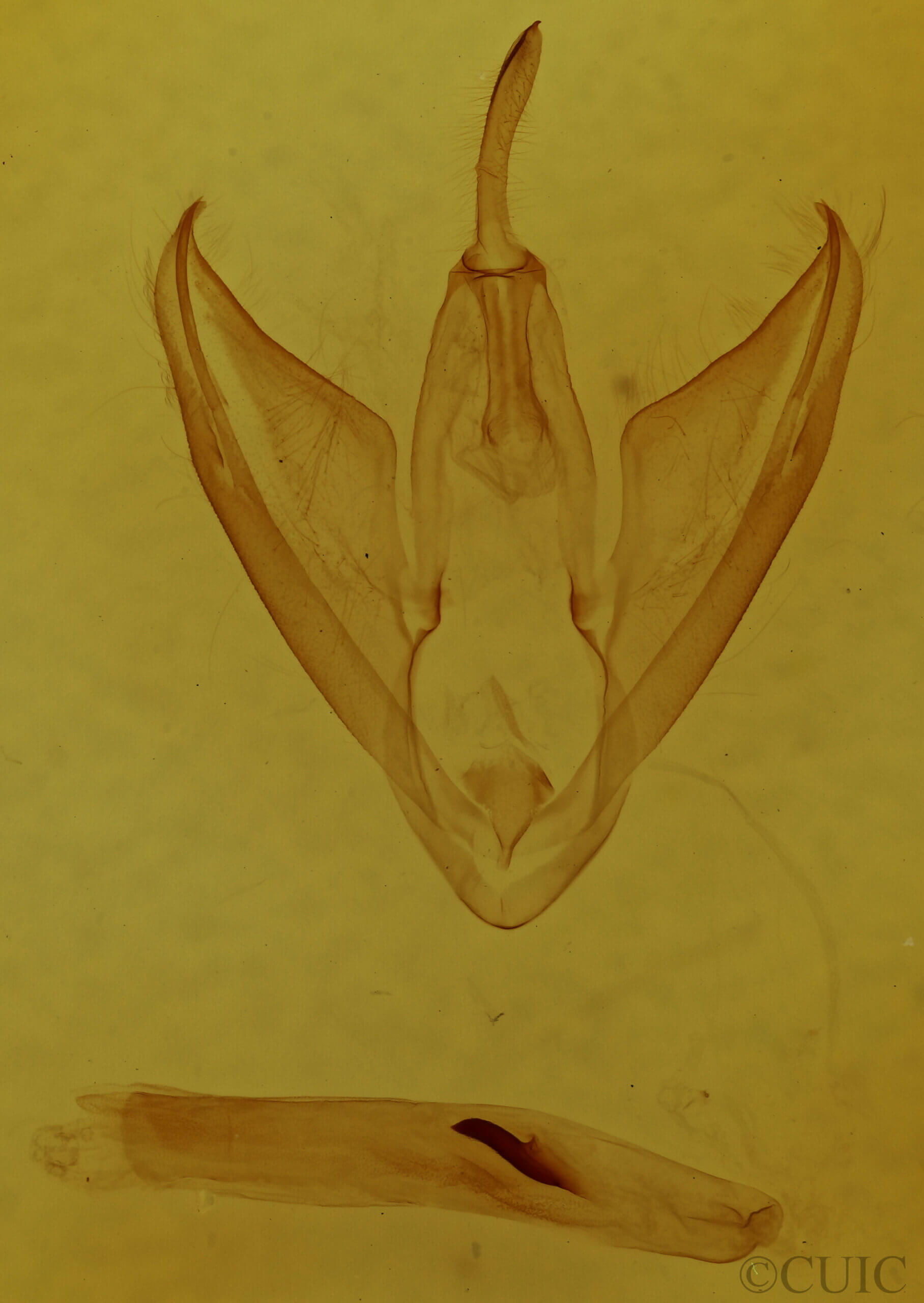 genitalia view of adult Calpe sp.