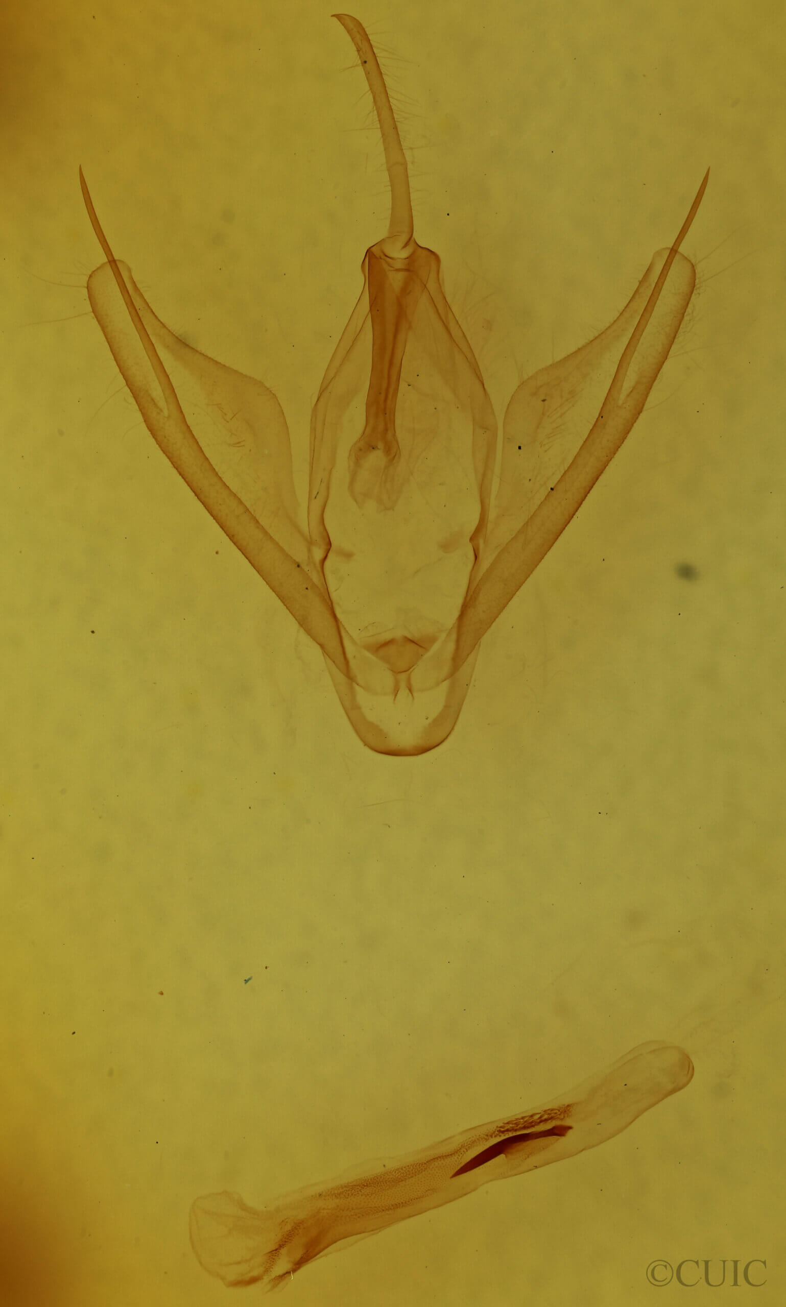 genitalia view of adult Calpe sp.